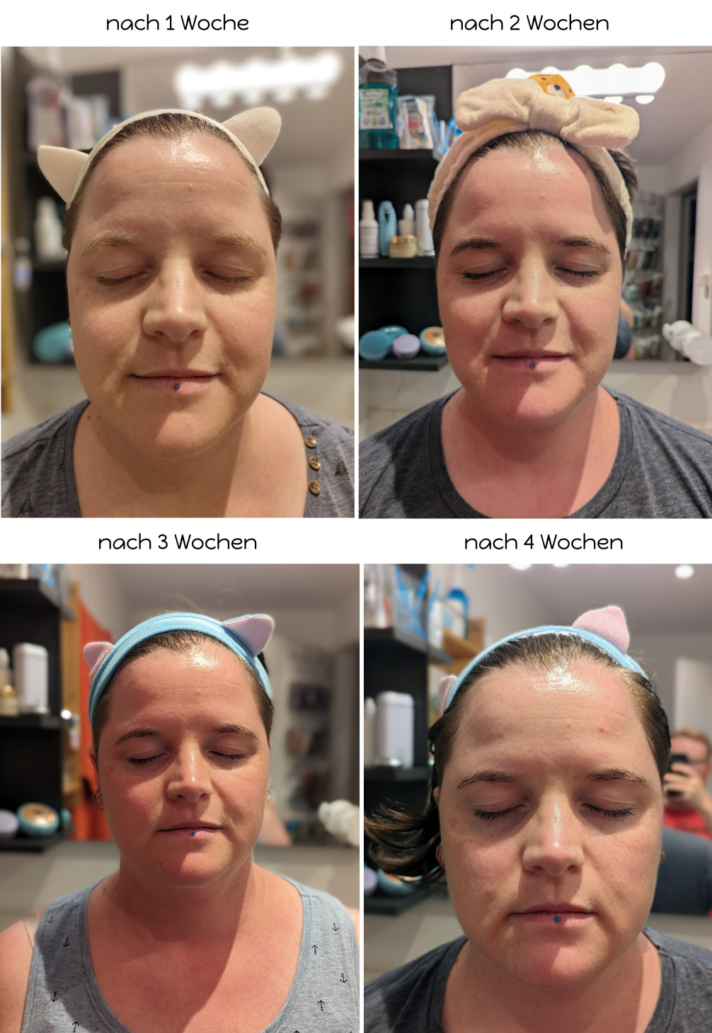 LED Lichttherapie-Maske von Koanna - Ergebnisse ganzes Gesicht